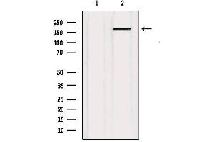 ABCC5 Antikörper  (N-Term)