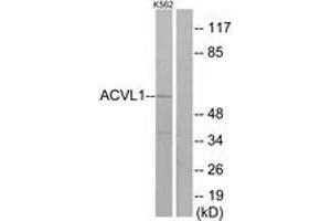 Image no. 1 for anti-Activin A Receptor Type II-Like 1 (ACVRL1) (AA 196-245) antibody (ABIN1533718)