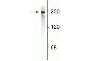 Image no. 3 for anti-Neurofilament, Heavy Polypeptide (NEFH) antibody (ABIN361351)