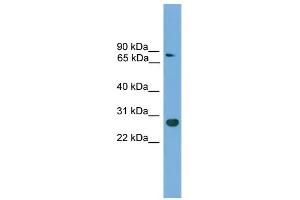 Image no. 1 for anti-Caudal Type Homeobox 1 (CDX1) (C-Term) antibody (ABIN2779925)