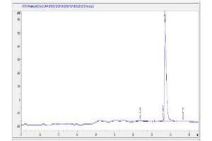 Image no. 1 for Pro-Brain Natriuretic Peptide (NT-ProBNP) (NT-ProBNP) (AA 39-53), (N-Term) peptide (Ovalbumin) (ABIN5666285)