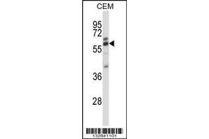 Image no. 1 for anti-Coronin, Actin Binding Protein, 2A (CORO2A) (AA 185-213) antibody (ABIN657512)
