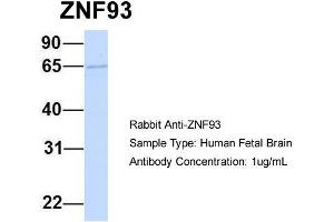 Host:  Rabbit  Target Name:  ZNF93  Sample Type:  Human Fetal Brain  Antibody Dilution:  1.