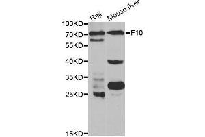 Image no. 1 for anti-Coagulation Factor X (F10) antibody (ABIN3021978)