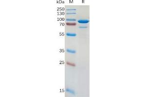 Image no. 1 for 5'-Nucleotidase, Ecto (CD73) (NT5E) protein (Fc Tag) (ABIN6964149)