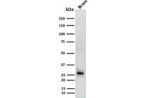 Image no. 1 for anti-Calbindin 2 (CALB2) (AA 23-242) antibody (ABIN6940931)