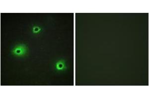 Image no. 2 for anti-Granzyme H (Cathepsin G-Like 2, Protein H-CCPX) (GZMH) (AA 51-100) antibody (ABIN1534447)