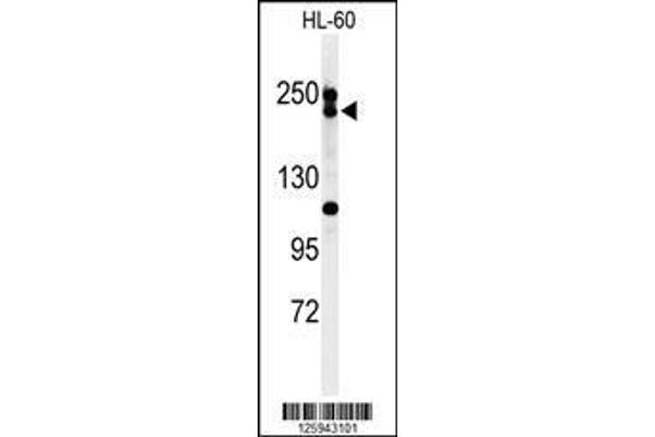 anti-Bloom Syndrome RecQ Like Helicase (BLM) (AA 1054-1082), (C-Term) antibody
