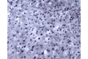 Image no. 2 for anti-Zinc Finger Protein 110 (ZFP110) (AA 600-650) antibody (ABIN351418)