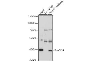 Image no. 5 for anti-Mitogen-Activated Protein Kinase 14 (MAPK14) antibody (ABIN6291833)