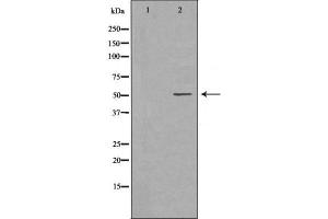 Image no. 2 for anti-Matrix Metallopeptidase 8 (Neutrophil Collagenase) (MMP8) (C-Term) antibody (ABIN6263288)