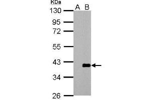 Image no. 1 for anti-Actin Related Protein 2/3 Complex, Subunit 1A, 41kDa (ARPC1A) (N-Term) antibody (ABIN2855928)