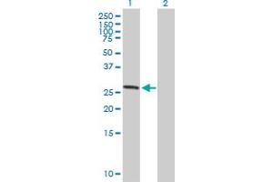 Image no. 1 for anti-Ankyrin Repeat and SOCS Box Containing 7 (ASB7) (AA 1-274) antibody (ABIN530776)