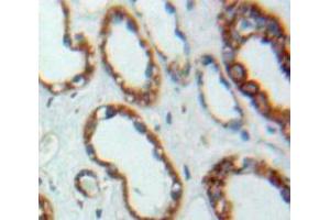 Image no. 3 for anti-Peroxisomal Biogenesis Factor 2 (PEX2) (AA 28-118) antibody (ABIN1860187)