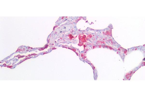 FTL antibody  (AA 2-175)