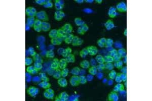 Image no. 2 for anti-Cathelicidin Antimicrobial Peptide (CAMP) antibody (ABIN350187)