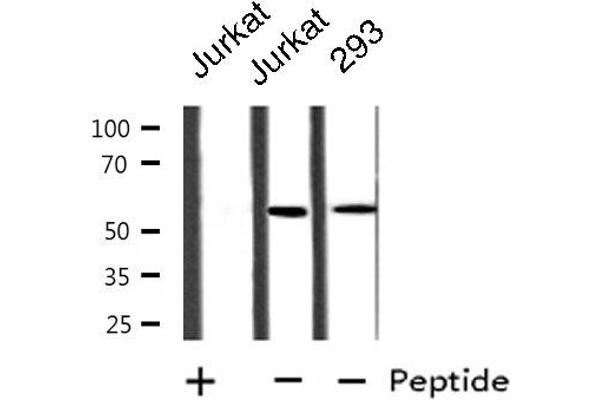 anti-Cytochrome P450, Family 21, Subfamily A, Polypeptide 2 (CYP21A2) (Internal Region) antibody