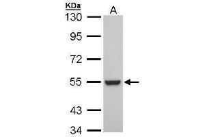 Image no. 1 for anti-Retinoid X Receptor, beta (RXRB) (N-Term) antibody (ABIN2855955)
