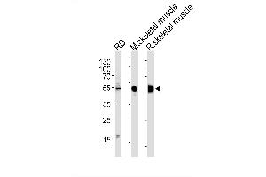 Image no. 2 for anti-Enolase 3 (Beta, Muscle) (ENO3) (AA 237-264) antibody (ABIN1882078)