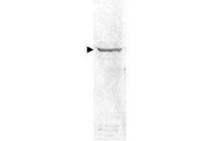 Image no. 1 for anti-Nuclear Factor kappa B (NFkB) antibody (ABIN965403)