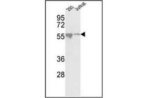 Image no. 2 for anti-Cyclin Dependent Kinase Like 2 (CDKL2) (AA 233-263) antibody (ABIN359259)