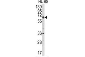 Image no. 1 for anti-Cytochrome P450, Family 2, Subfamily C, Polypeptide 18 (CYP2C18) (C-Term) antibody (ABIN453597)