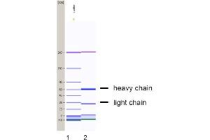Image no. 3 for anti-Fc Receptor (FcRn) antibody (ABIN1774762)