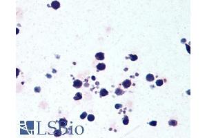 Image no. 5 for anti-NLR Family, Pyrin Domain Containing 3 (NLRP3) (C-Term) antibody (ABIN184887)