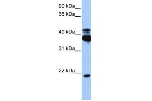 Image no. 1 for anti-serine/threonine Kinase 38 (STK38) (C-Term) antibody (ABIN2783482)