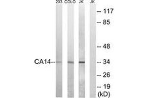Image no. 1 for anti-Carbonic Anhydrase XIV (CA14) (AA 161-210) antibody (ABIN1534726)