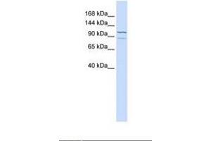 anti-Adenylate Cyclase 6 (ADCY6) (AA 794-843) antibody