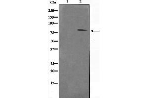 Image no. 2 for anti-Signal Transducer and Activator of Transcription 1, 91kDa (STAT1) (pTyr701) antibody (ABIN6255991)