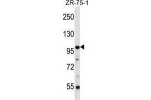 Image no. 1 for anti-Zinc Finger Protein 845 (ZNF845) (AA 79-108), (N-Term) antibody (ABIN955748)