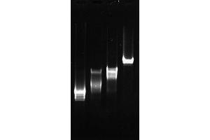 Image no. 2 for Sjogren Syndrome Antigen B (SSB) (Active) protein (ABIN2452175)