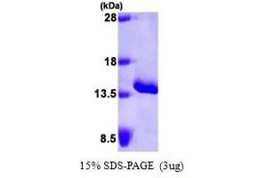 Image no. 1 for Serum Amyloid A (SAA) (AA 19-122) protein (His tag) (ABIN666889)