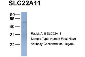 Image no. 2 for anti-Solute Carrier Family 22 (Organic Cation Transporter), Member 11 (SLC22A11) (C-Term) antibody (ABIN2781664)