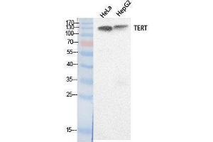 Image no. 1 for anti-Telomerase Reverse Transcriptase (TERT) (Internal Region) antibody (ABIN3181058)