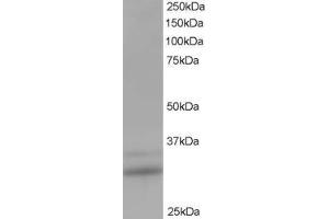 Image no. 2 for anti-HIV-1 Tat Interactive Protein 2, 30kDa (HTATIP2) (N-Term) antibody (ABIN185205)