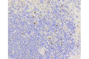 Image no. 2 for anti-Antigen Identified By Monoclonal Antibody Ki-67 (MKI67) antibody (ABIN4904148)