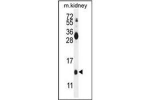 Image no. 4 for anti-Midkine (Neurite Growth-Promoting Factor 2) (MDK) (AA 110-143), (C-Term) antibody (ABIN953444)