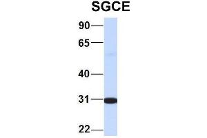 Image no. 7 for anti-Sarcoglycan, epsilon (SGCE) (N-Term) antibody (ABIN2782610)