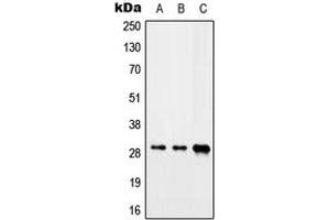 Western blot analysis of CIP29 expression in Jurkat (A), mouse heart (B), rat liver (C) whole cell lysates.