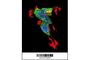 Image no. 5 for anti-Catenin (Cadherin-Associated Protein), beta 1, 88kDa (CTNNB1) (AA 78-106), (N-Term) antibody (ABIN1881239)