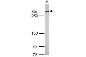 Image no. 1 for anti-Fatty Acid Synthase (FASN) (N-Term) antibody (ABIN2856708)
