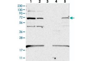 Image no. 1 for anti-Eukaryotic Elongation Factor, Selenocysteine-tRNA-Specific (EEFSEC) antibody (ABIN5577015)