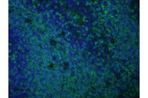 Immunofluorescence of anti rat IgG antibody Tissue: Normal mouse spleen Fixation: methanol frozen Antigen retrieval: user optimized Primary antibody: AbD Serotec's Rat anti-mouse CD3 antibody (KT3 clone).