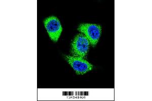 Image no. 3 for anti-Topoisomerase (DNA) II alpha 170kDa (TOP2A) (AA 1167-1196), (C-Term) antibody (ABIN653195)
