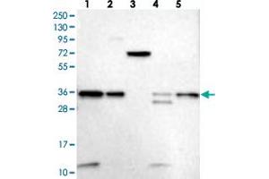 Image no. 1 for anti-Vacuolar Protein Sorting 37 Homolog B (VPS37B) antibody (ABIN5590794)