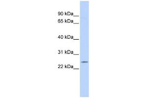 Image no. 1 for anti-Proteasome (Prosome, Macropain) Subunit, beta Type, 5 (PSMB5) (Middle Region) antibody (ABIN2786720)