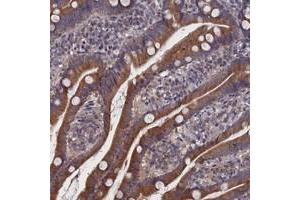 Image no. 1 for anti-Spermatogenesis Associated 13 (SPATA13) antibody (ABIN5588598)